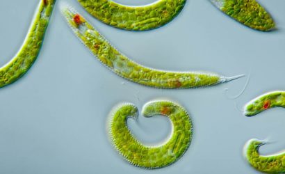 Protistler Tek Hücreli Midir ?